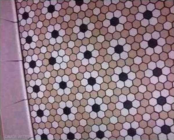 ocd