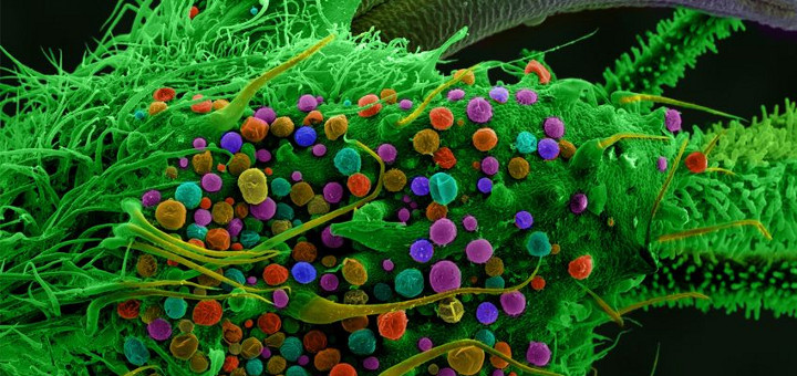 Cannabis Under The Microscope/Neatorama