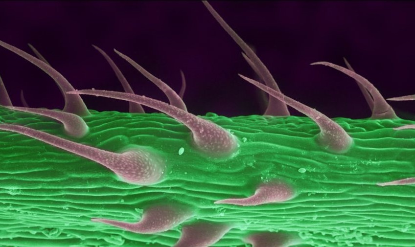 Cannabis Under The Microscope/Neatorama