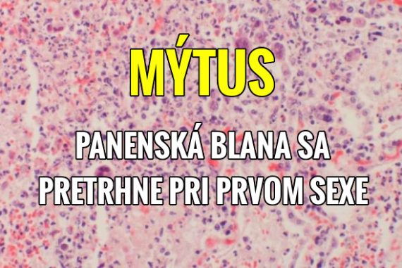 zadarmo vzorka Ázijské porno klipu
