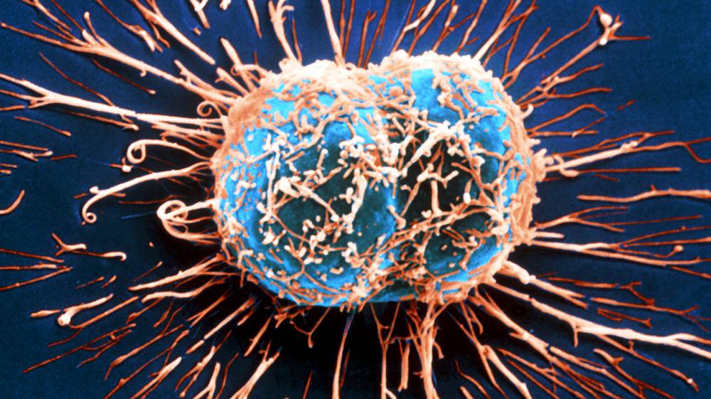 Two cervical cancer cells divide in this image from a scanning electron microscope.