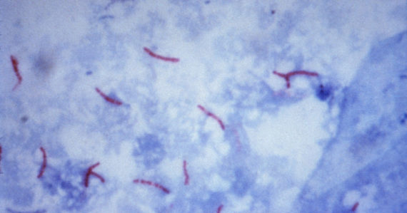 Tuberkulóza vírus