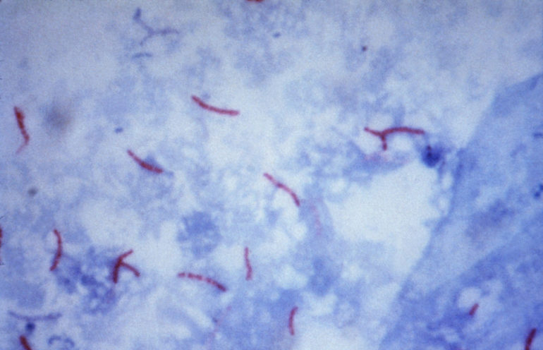 Tuberkulóza vírus