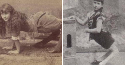 Dievča so zdeformovanými kolenami: Týždenne zarábala 6-tisíc, ľudia sa jej smiali, mysleli si, že je napoly ťava