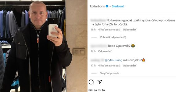Ľudia sa smejú novému účesu Borisa Kollára: Ukázal sa po transplantácii vlasov, nevyzerá to vábne, odkazujú mu