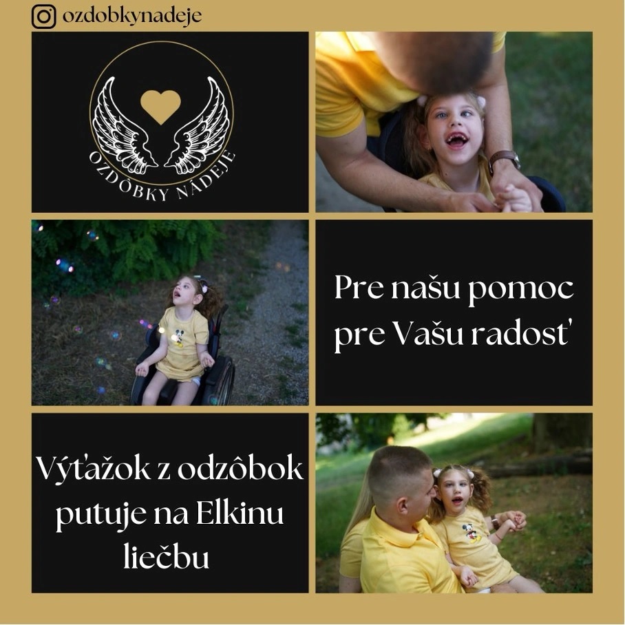 ozdobky