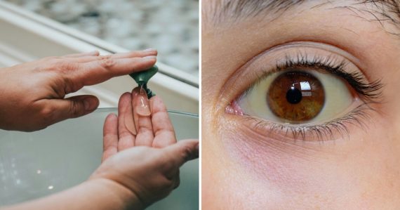 Rodičia sú zúfalí, na Slovensku chýba dôležitá vakcína. Pre svoje deti ju zháňajú v zahraničí