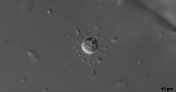 Slovenskí a českí vedci prepíšu učebnice biológie: Objavili jednobunkový organizmus, aký už nemal existovať