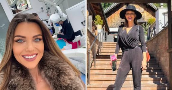 Dala sa vylepšiť. Martina Schindlerová prekvapila a podstúpila ďalší estetický zákrok, akú procedúru má za sebou?