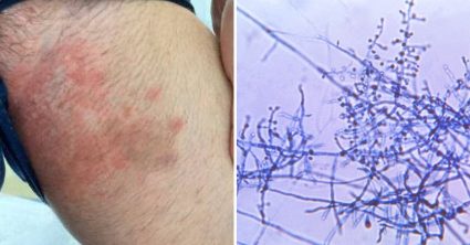 Pozri aj tento článok