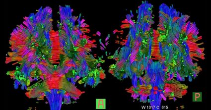 Pozri aj tento článok