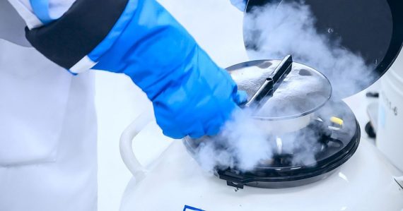 Dlhé roky bol darcom spermií, deťom tým spôsobil rakovinu. Muž má vzácnu chorobu, vôbec o tom nevedel