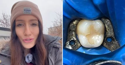 Stačí poznať tento rýchly trik: Zubárka radí, ako zachrániť vybitý zub. Ušetriť môžete až stovky eur