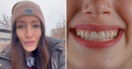 Zubárka Andrea poradí, ako ušetríte stovky eur: Mala pacientku, čo si zlomila zub pri zapekanej brokolici