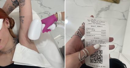 Bola som na laserovej epilácii: Nahotu po chvíľke neriešite. Najviac ma prekvapila poloha, v akej som musela ležať