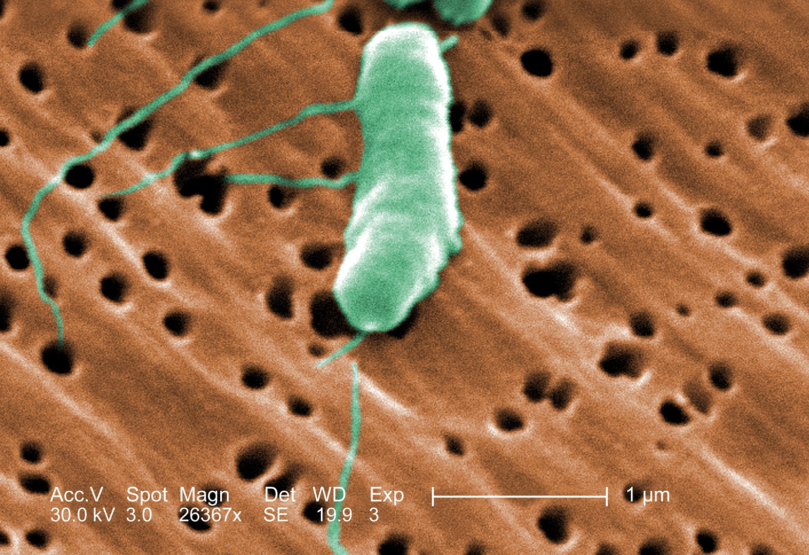 Vibrio vulnificus