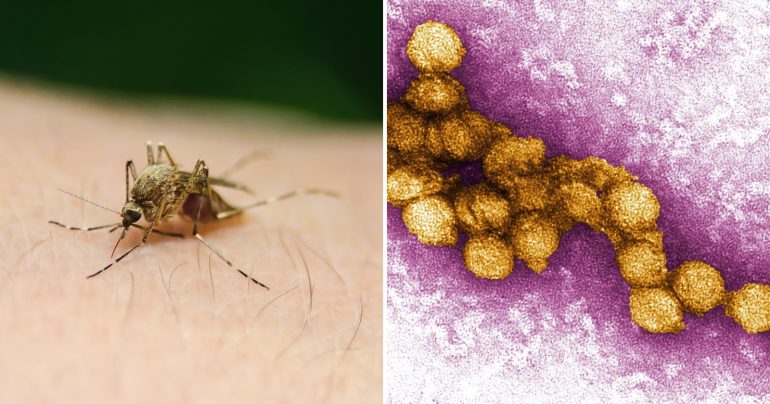 Komár a západonílska horúčka pod mikroskopom