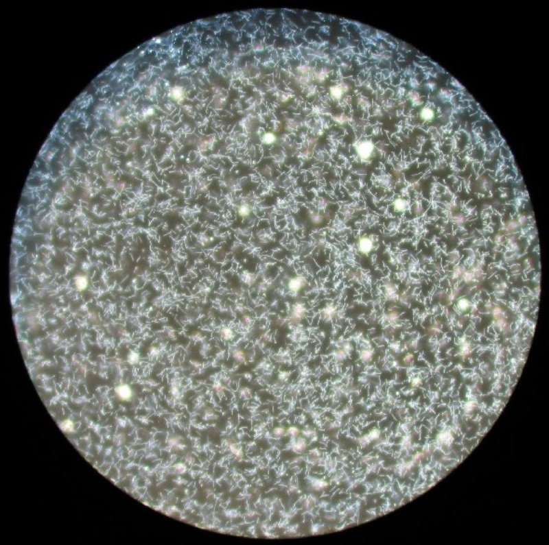 Leptospira pod mikroskopom