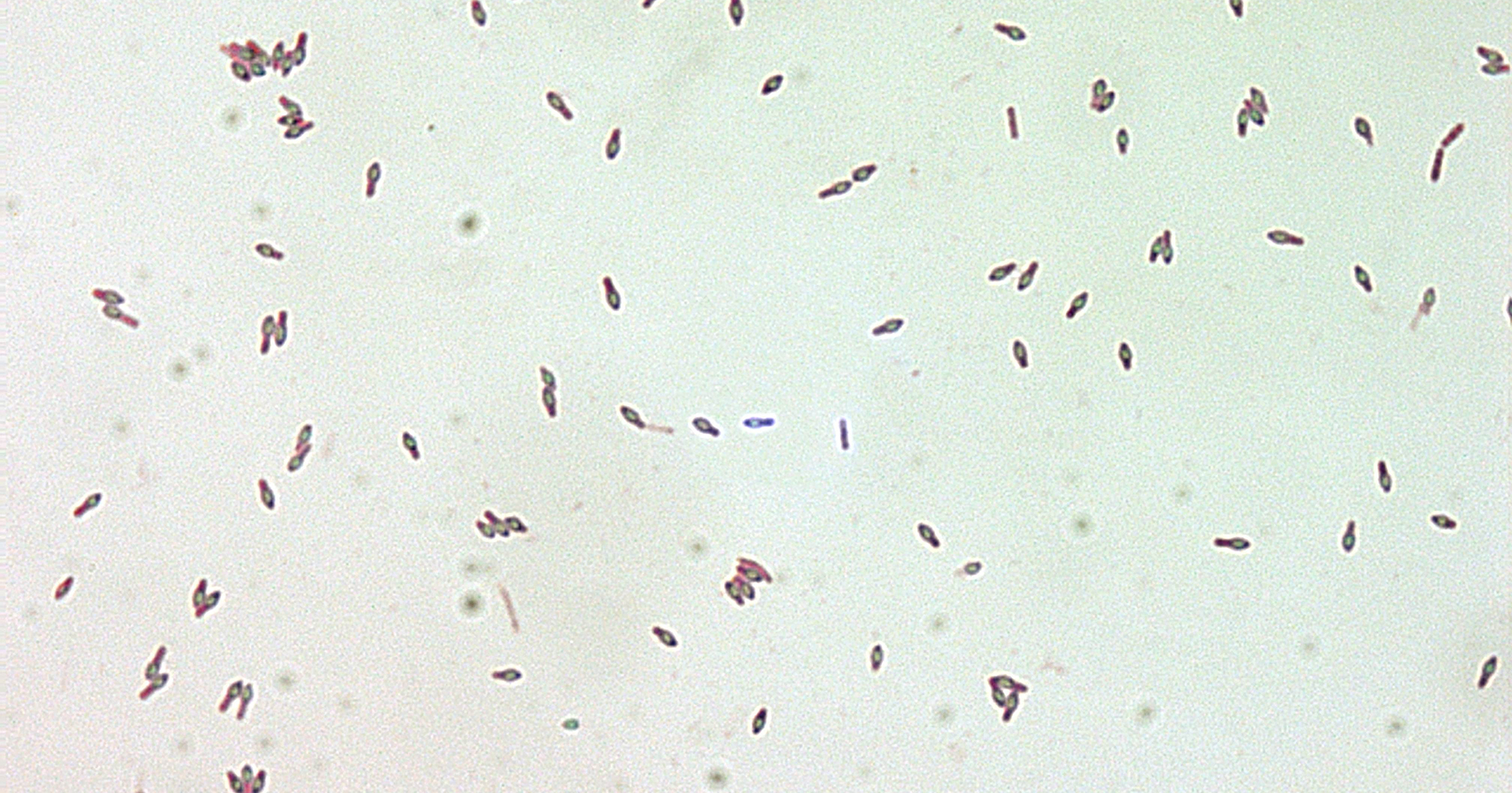 Clostridium botulinum