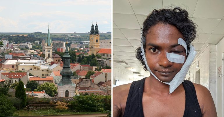 Mesto Nitra a zranení indický učiteľ