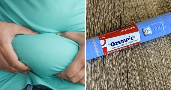 Tuk a ozempic